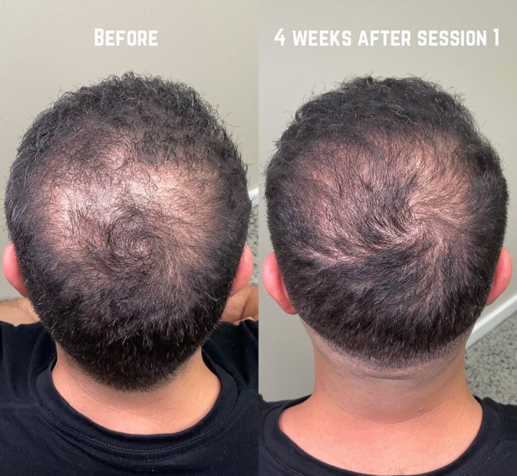 before and after hair treatment